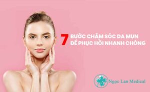 7 bước chăm sóc da mụn để phục hồi nhanh chóng